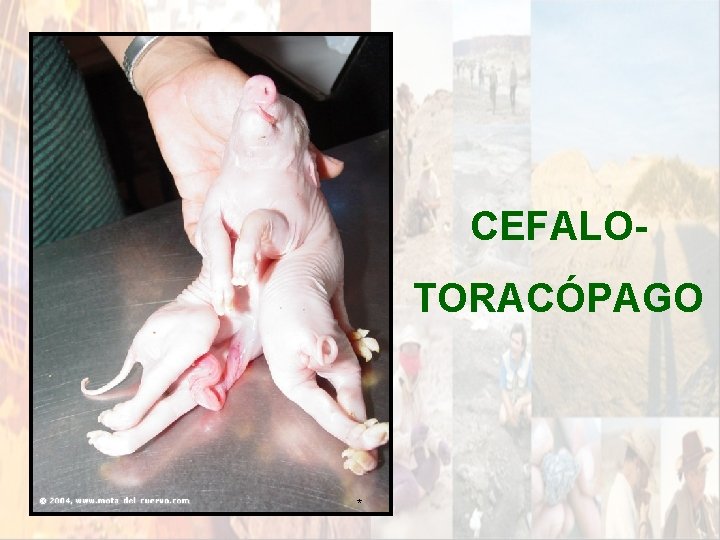 CEFALOTORACÓPAGO * CEFALOTORACÓPAGO *