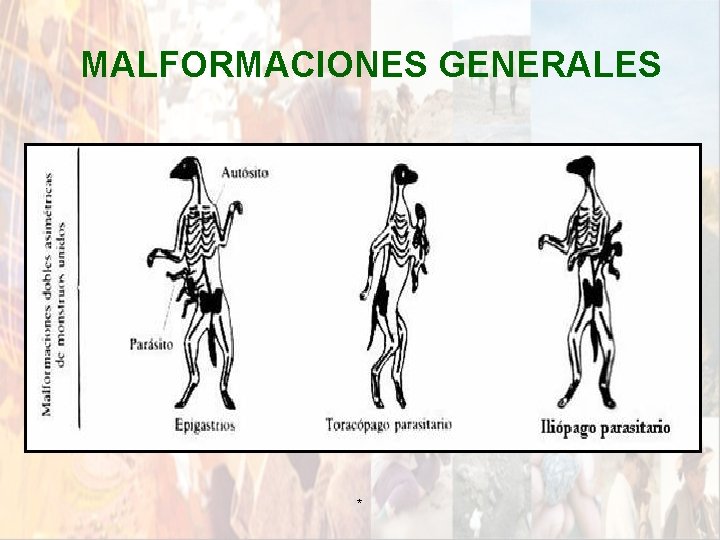 MALFORMACIONES GENERALES * MALFORMACIONES GENERALES *