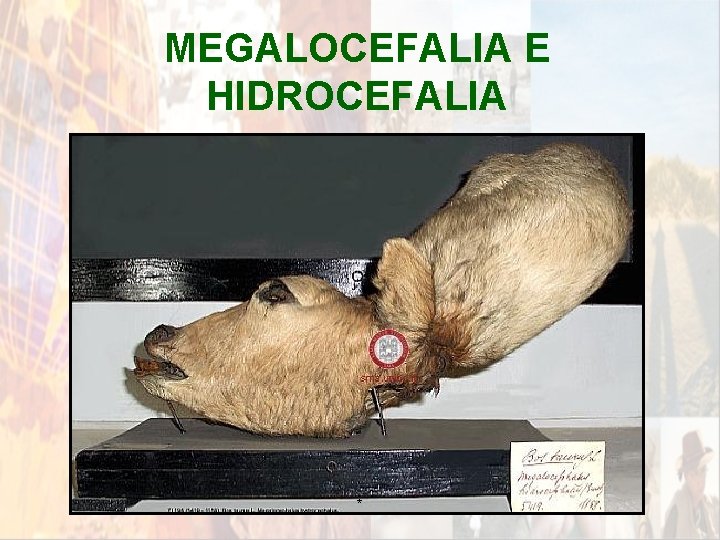 MEGALOCEFALIA E HIDROCEFALIA * MEGALOCEFALIA E HIDROCEFALIA *