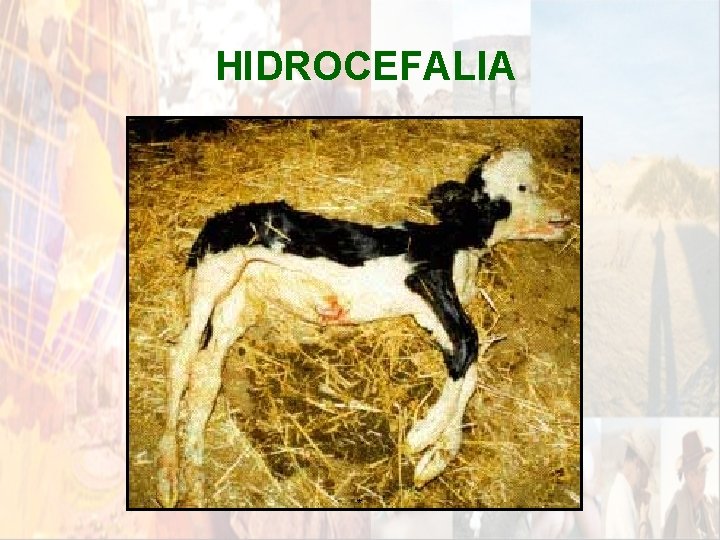 HIDROCEFALIA * HIDROCEFALIA *