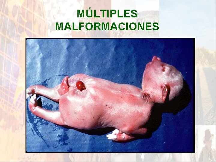 MÚLTIPLES MALFORMACIONES * MÚLTIPLES MALFORMACIONES *