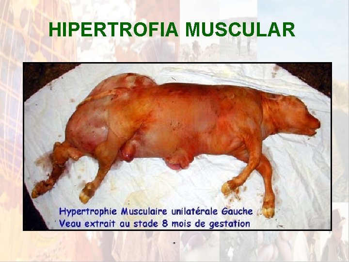 HIPERTROFIA MUSCULAR * HIPERTROFIA MUSCULAR *