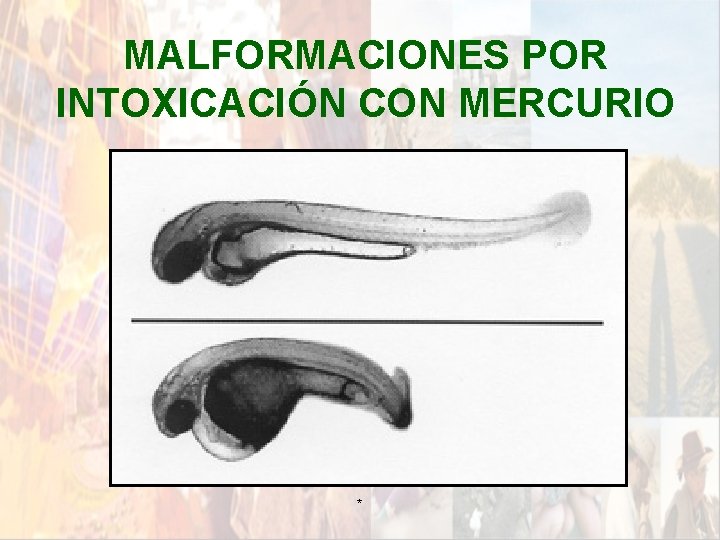 MALFORMACIONES POR INTOXICACIÓN CON MERCURIO * MALFORMACIONES POR INTOXICACIÓN CON MERCURIO *