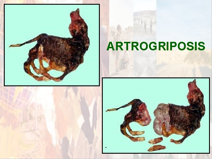 ARTROGRIPOSIS * ARTROGRIPOSIS *
