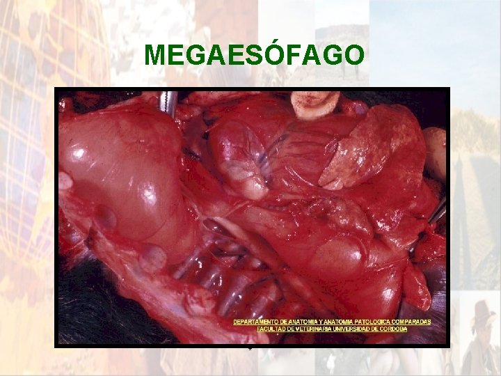 MEGAESÓFAGO * MEGAESÓFAGO *