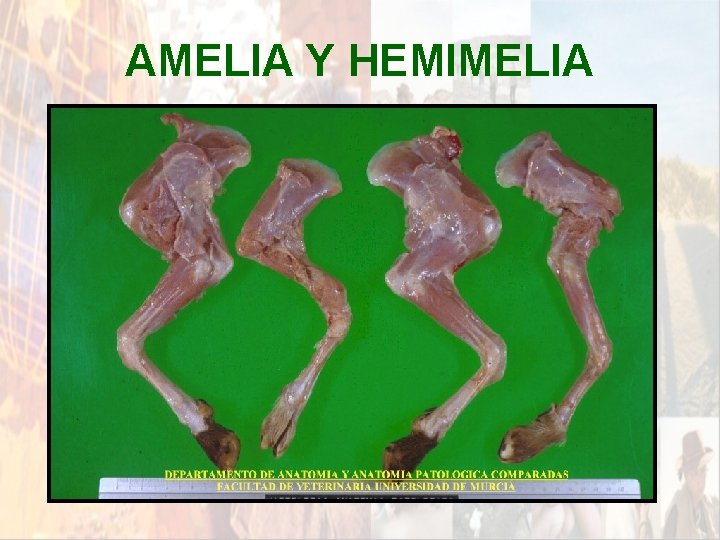 AMELIA Y HEMIMELIA * AMELIA Y HEMIMELIA *
