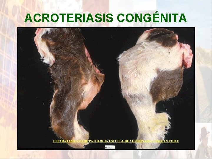 ACROTERIASIS CONGÉNITA * ACROTERIASIS CONGÉNITA *