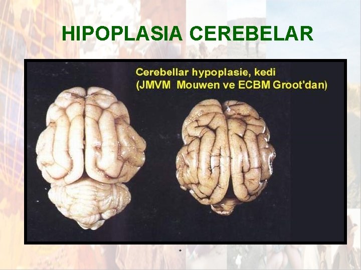 HIPOPLASIA CEREBELAR * HIPOPLASIA CEREBELAR *