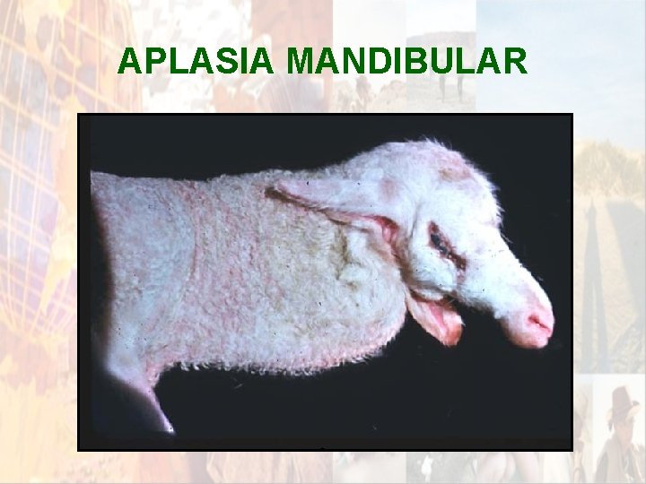 APLASIA MANDIBULAR * APLASIA MANDIBULAR *