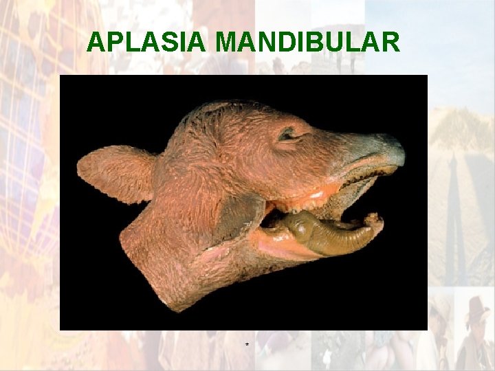 APLASIA MANDIBULAR * APLASIA MANDIBULAR *