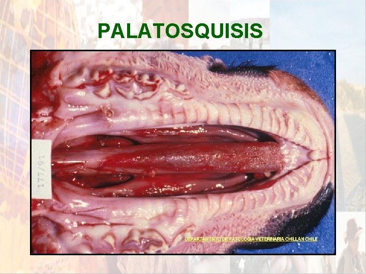 PALATOSQUISIS * PALATOSQUISIS *