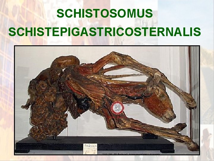 SCHISTOSOMUS SCHISTEPIGASTRICOSTERNALIS * SCHISTOSOMUS SCHISTEPIGASTRICOSTERNALIS *