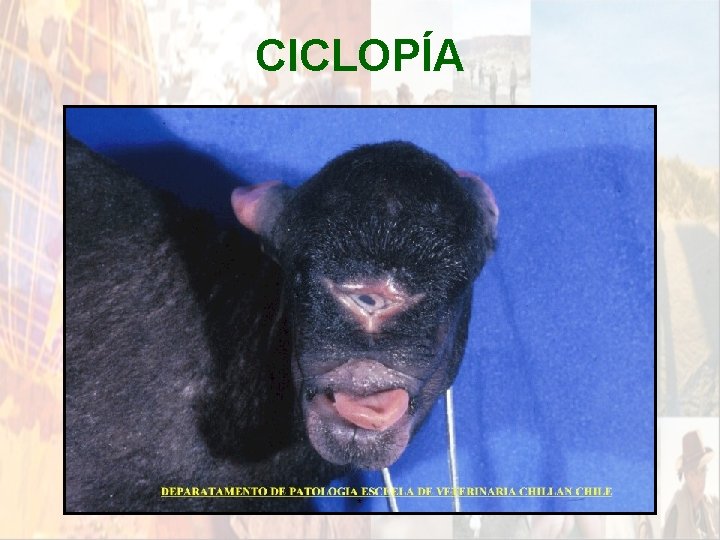 CICLOPÍA * CICLOPÍA *
