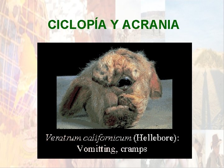 CICLOPÍA Y ACRANIA * CICLOPÍA Y ACRANIA *