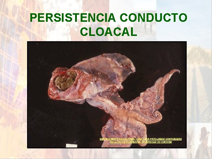 PERSISTENCIA CONDUCTO CLOACAL * PERSISTENCIA CONDUCTO CLOACAL *