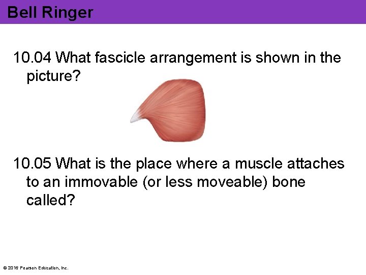 Bell Ringer 10. 04 What fascicle arrangement is shown in the picture? 10. 05 Bell Ringer 10. 04 What fascicle arrangement is shown in the picture? 10. 05