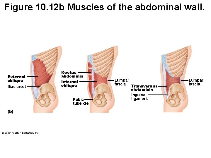 Figure 10. 12 b Muscles of the abdominal wall. External oblique IIiac crest Rectus Figure 10. 12 b Muscles of the abdominal wall. External oblique IIiac crest Rectus