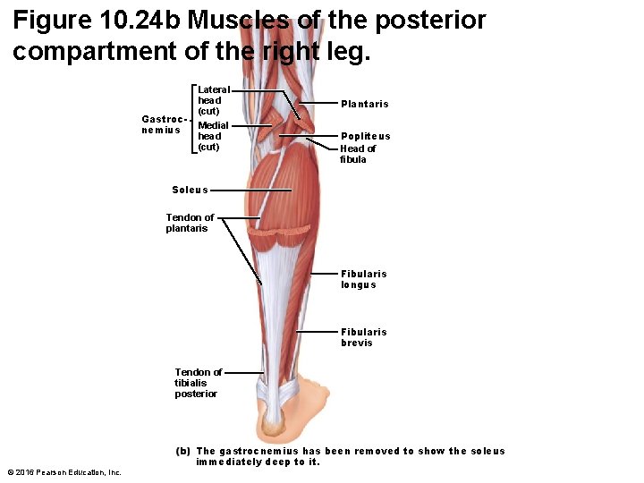 Figure 10. 24 b Muscles of the posterior compartment of the right leg. Gastrocnemius Figure 10. 24 b Muscles of the posterior compartment of the right leg. Gastrocnemius