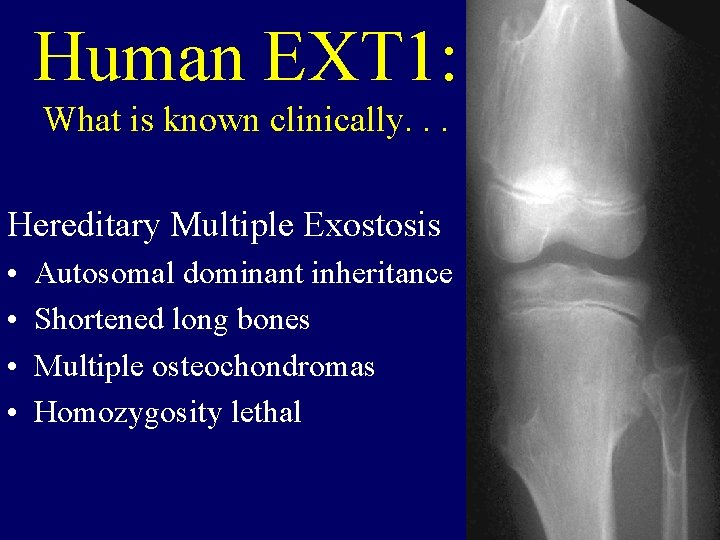 Human EXT 1: What is known clinically. . . Hereditary Multiple Exostosis • •