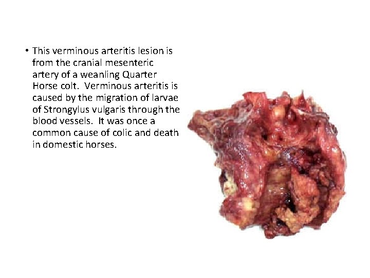  • This verminous arteritis lesion is from the cranial mesenteric artery of a