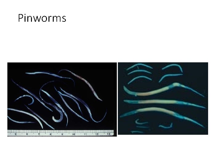 Pinworms 