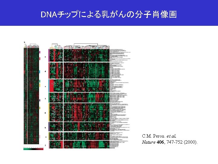 DNAチップによる乳がんの分子肖像画 C. M. Perou. et al. Nature 406, 747 -752 (2000). 