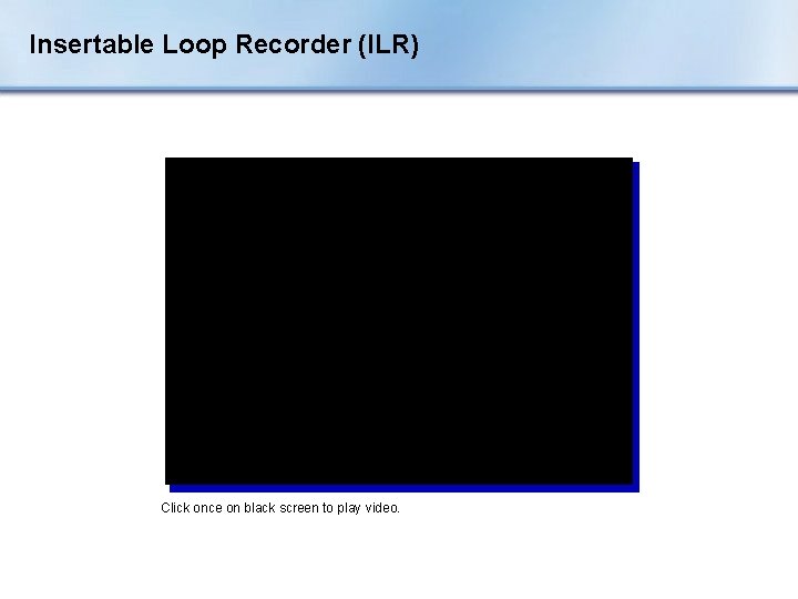 Insertable Loop Recorder (ILR) Click once on black screen to play video. 