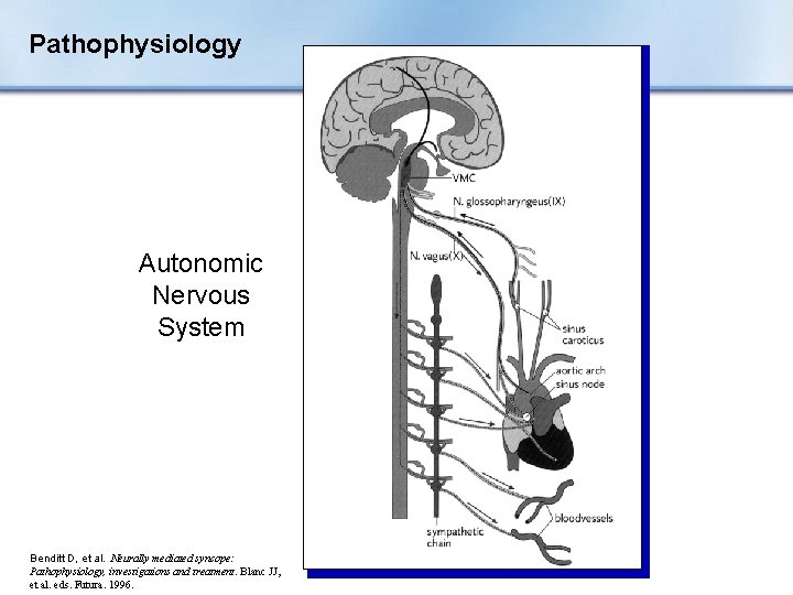 Pathophysiology Autonomic Nervous System Benditt D, et al. Neurally mediated syncope: Pathophysiology, investigations and