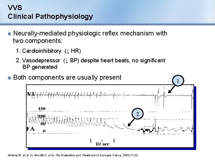 VVS Clinical Pathophysiology n Neurally-mediated physiologic reflex mechanism with two components: 1. Cardioinhibitory (↓