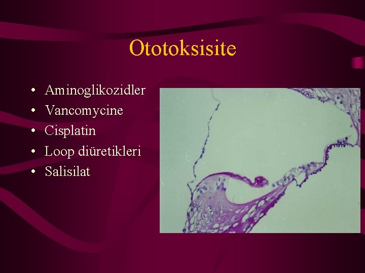 Ototoksisite • • • Aminoglikozidler Vancomycine Cisplatin Loop diüretikleri Salisilat 