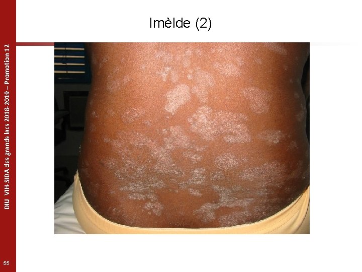 DIU VIH-SIDA des grands lacs 2018 -2019 – Promotion 12 Imèlde (2) 55 