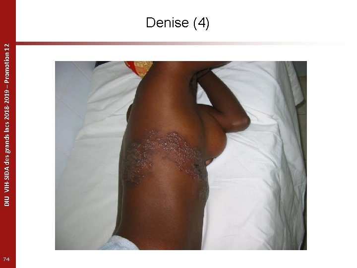 DIU VIH-SIDA des grands lacs 2018 -2019 – Promotion 12 Denise (4) 74 