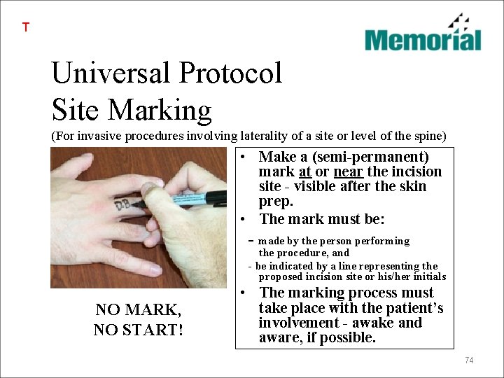 T Universal Protocol Site Marking (For invasive procedures involving laterality of a site or