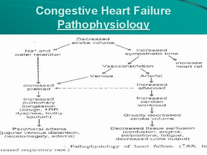 Congestive Heart Failure Pathophysiology 