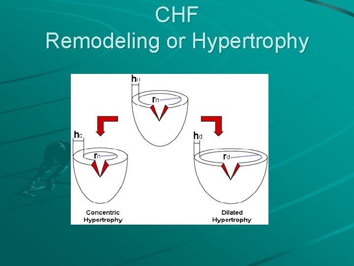 CHF Remodeling or Hypertrophy 