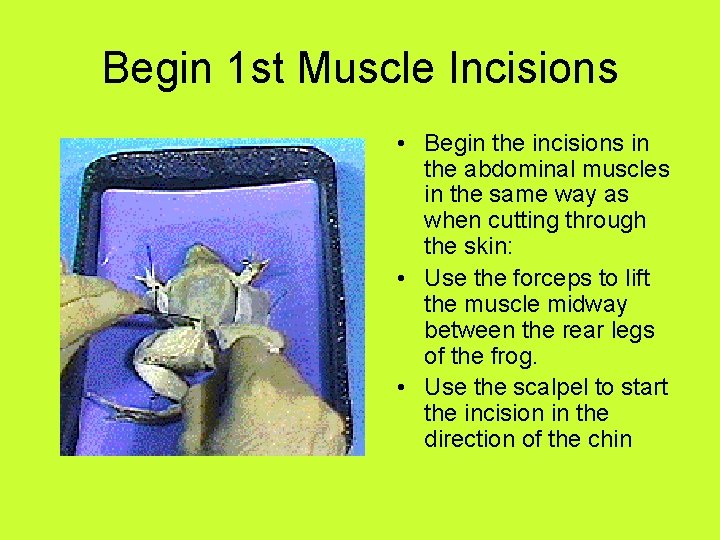 Begin 1 st Muscle Incisions • Begin the incisions in the abdominal muscles in