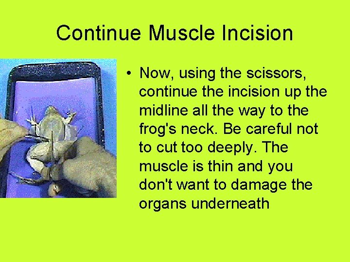 Continue Muscle Incision • Now, using the scissors, continue the incision up the midline