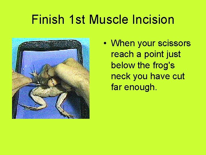 Finish 1 st Muscle Incision • When your scissors reach a point just below