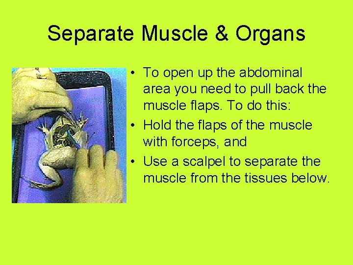 Separate Muscle & Organs • To open up the abdominal area you need to