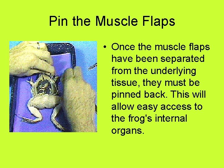 Pin the Muscle Flaps • Once the muscle flaps have been separated from the