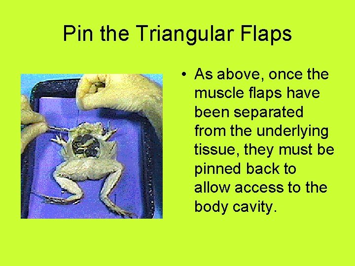 Pin the Triangular Flaps • As above, once the muscle flaps have been separated