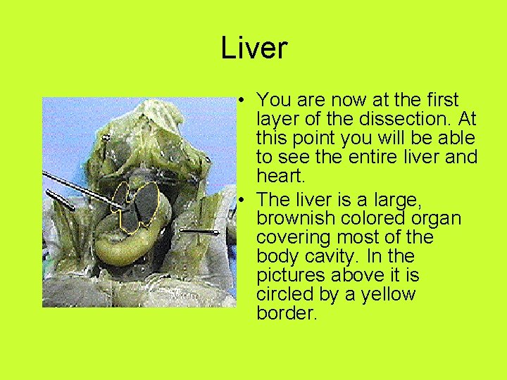 Liver • You are now at the first layer of the dissection. At this