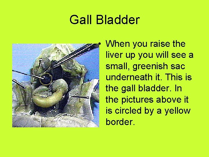 Gall Bladder • When you raise the liver up you will see a small,