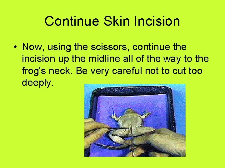 Continue Skin Incision • Now, using the scissors, continue the incision up the midline