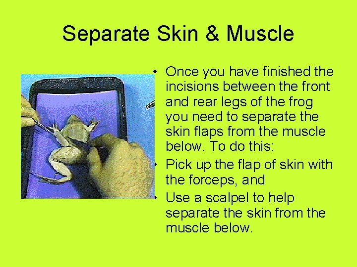 Separate Skin & Muscle • Once you have finished the incisions between the front