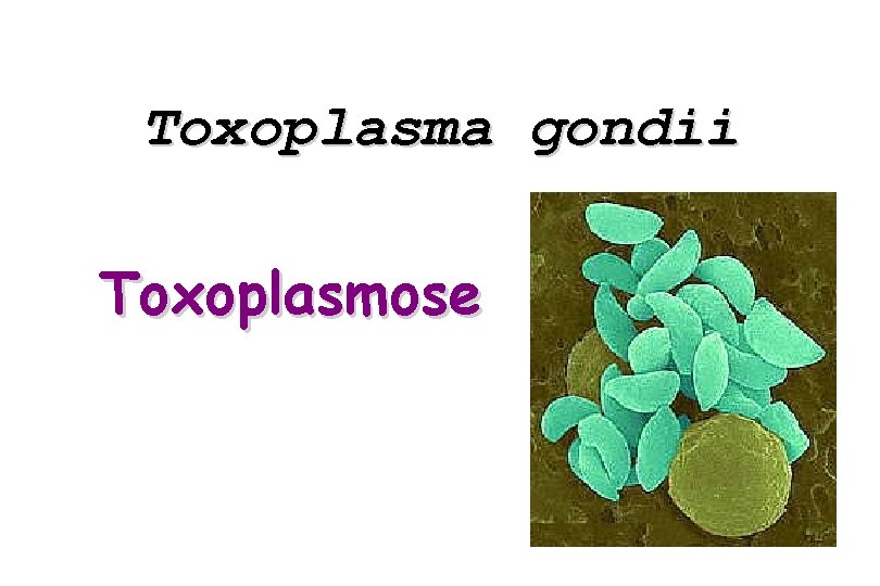 Toxoplasma gondii Toxoplasmose 