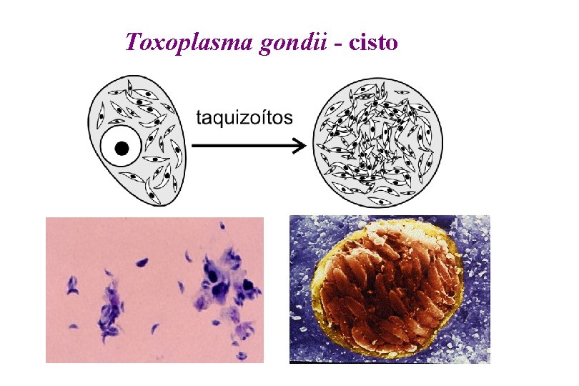 Toxoplasma gondii - cisto 