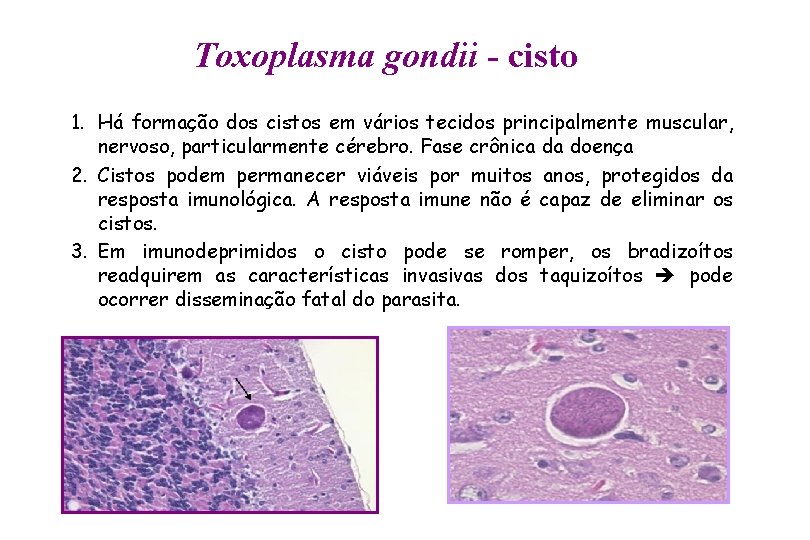 Toxoplasma gondii - cisto 1. Há formação dos cistos em vários tecidos principalmente muscular,