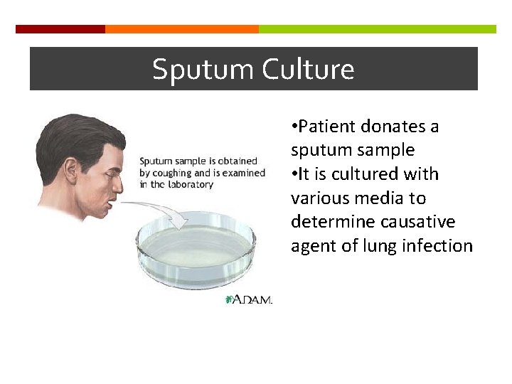 Sputum Culture • Patient donates a sputum sample • It is cultured with various