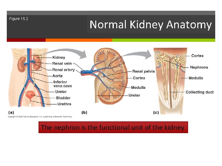 Figure 15. 2 Normal Kidney Anatomy The nephron is the functional unit of the